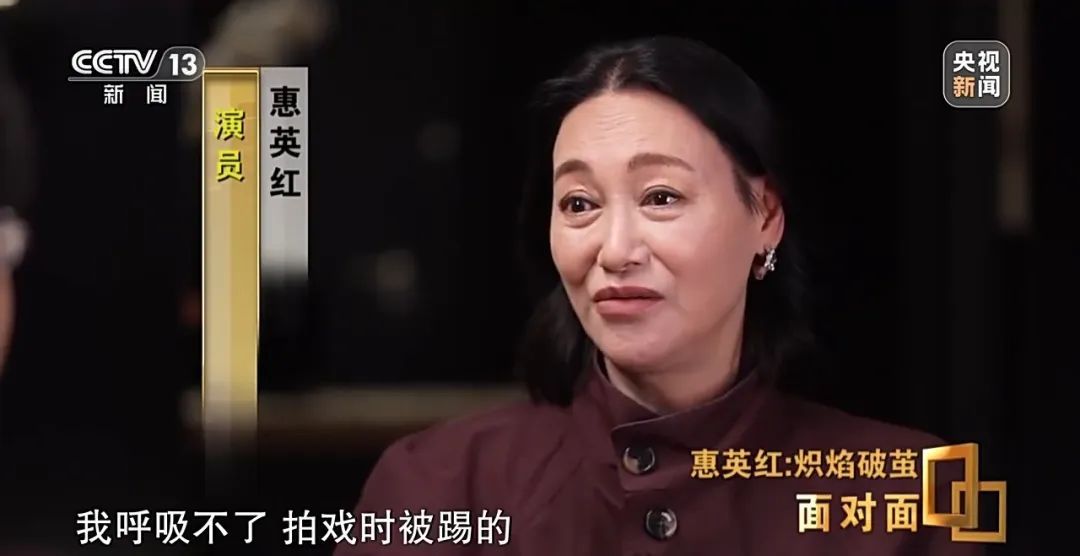 65岁惠英红称曾因抑郁5年没法出门，回应“脸上缝过89针”