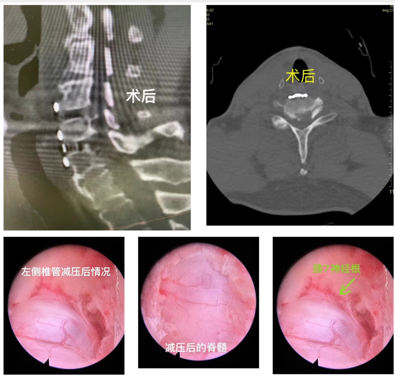 男子脚趾突然“失灵”!医生:病根在脖子 男子脚趾突然“失灵”!医生:病根在脖子