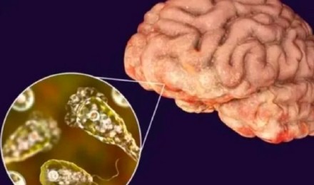 两幼童相继感染“食脑虫”病情危急,专家:尽量避免孩子“野泳” 两幼童相继感染“食脑虫”病情危急,专家:尽量避免孩子“野泳”