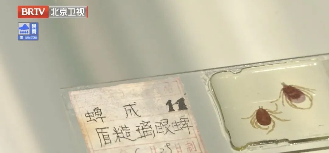 危险！身上忽然冒出这种小黑点，要尽快处理