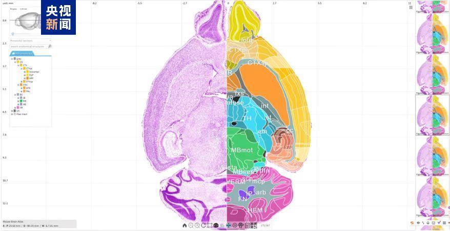 探索脑部奥秘 中国科学家有新进展