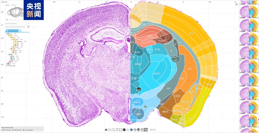 探索脑部奥秘 中国科学家有新进展