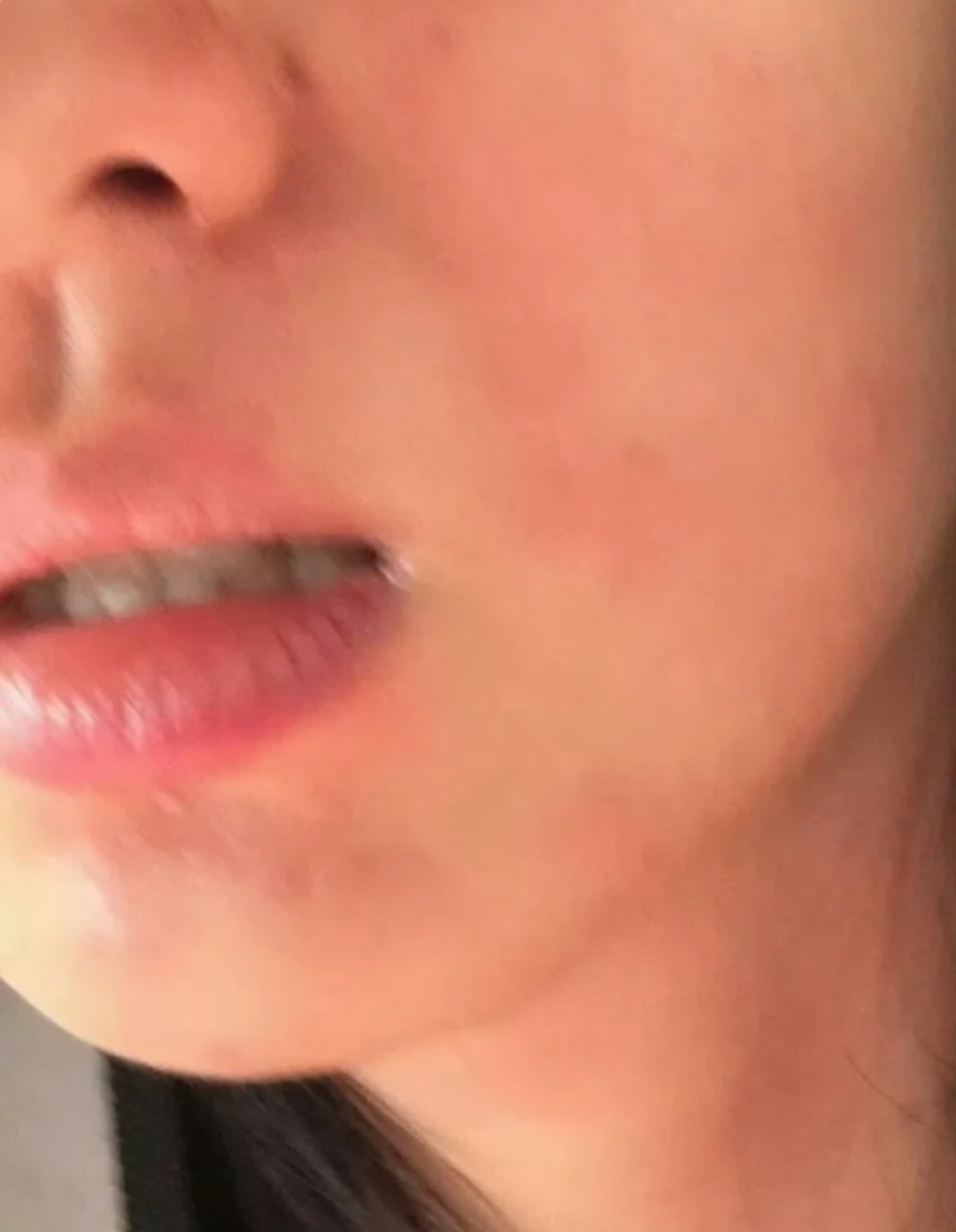 “痒到崩溃”!女演员晒照求助:从小反复发作找不到病因,过度开心伤心都会有 “痒到崩溃”!女演员晒照求助:从小反复发作找不到病因,过度开心伤心都会有