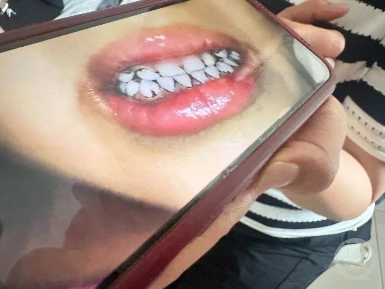 有孩子掉头发、流鼻血、牙齿发黑！官方通报：幼儿园负责人被立案侦查