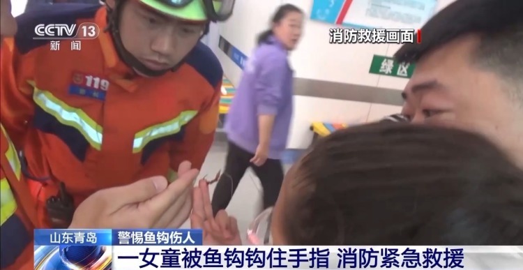 散步被鱼钩钩脸、孩子额头被刺穿……警惕鱼钩伤人! 散步被鱼钩钩脸、孩子额头被刺穿……警惕鱼钩伤人!