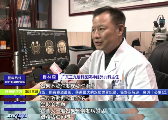 七旬老人手脚不断变大！以为这是二度发育，祸因竟是脑肿瘤→