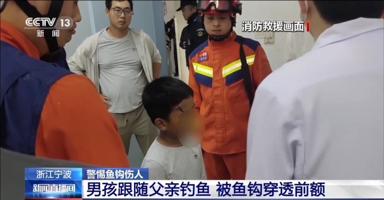 散步被鱼钩钩脸、孩子额头被刺穿……警惕鱼钩伤人! 散步被鱼钩钩脸、孩子额头被刺穿……警惕鱼钩伤人!