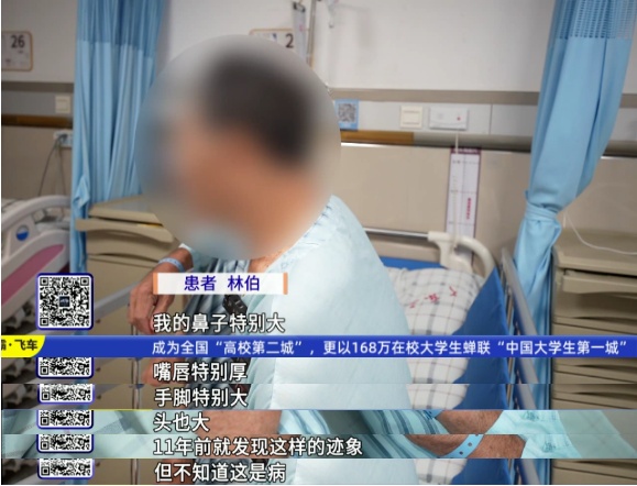 七旬老人手脚不断变大！以为这是二度发育，祸因竟是脑肿瘤→
