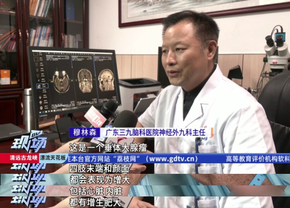 七旬老人手脚不断变大！以为这是二度发育，祸因竟是脑肿瘤→