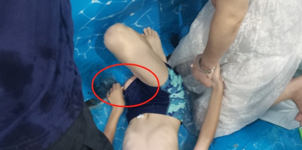 惊险!男孩整条左腿被泳池死死“咬住” 惊险!男孩整条左腿被泳池死死“咬住”