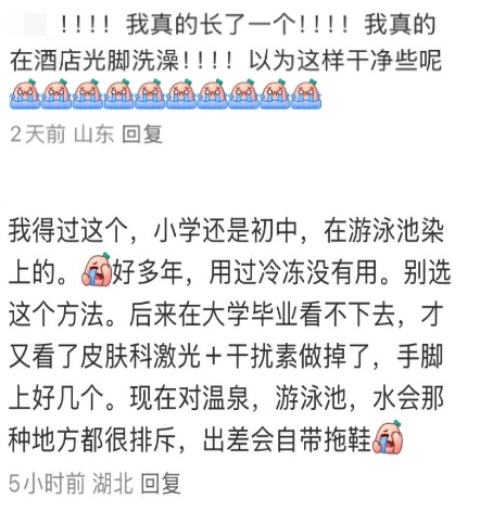 在酒店光脚洗澡后感染HPV？真相来了！医生提醒：避免在公共场所光脚