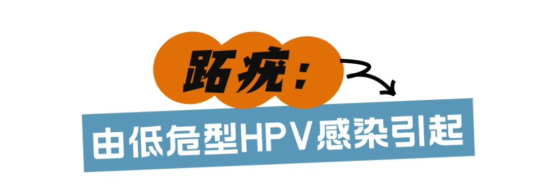 在酒店光脚洗澡后感染HPV？真相来了！医生提醒：避免在公共场所光脚