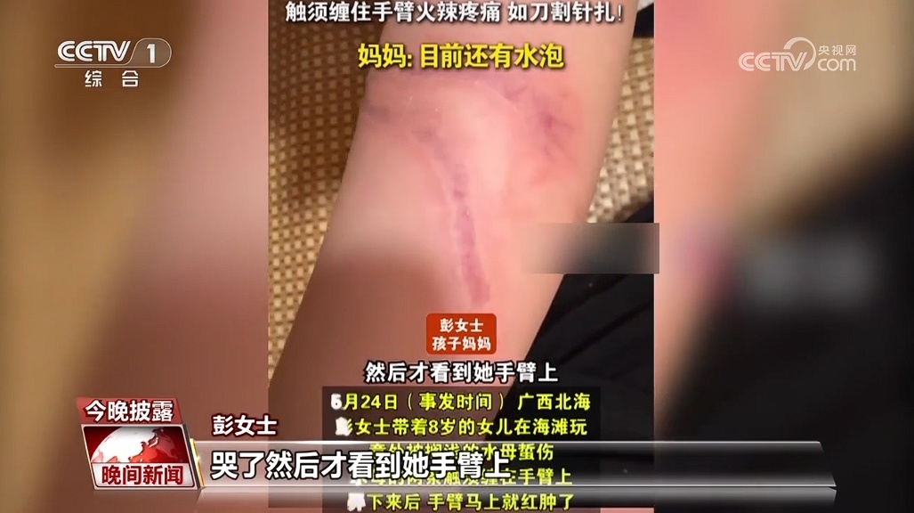 守护儿童假期安全 这些知识要牢记