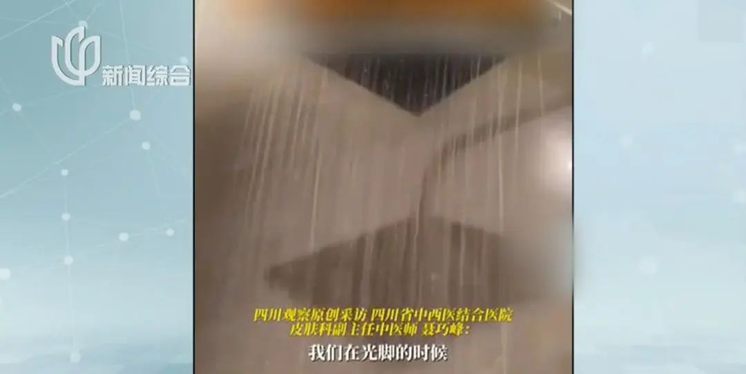 酒店光脚洗澡后感染!暑期出行小心这种病毒 酒店光脚洗澡后感染!暑期出行小心这种病毒