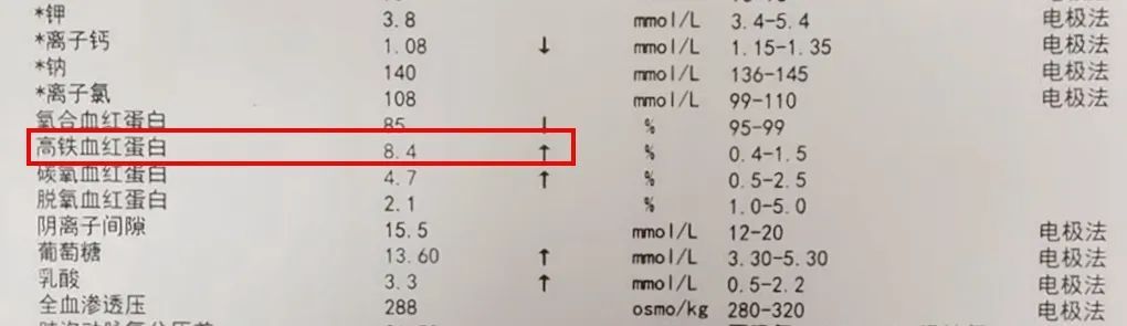 紧急送医!64岁老人吃完这道家常菜,差点没命! 紧急送医!64岁老人吃完这道家常菜,差点没命!
