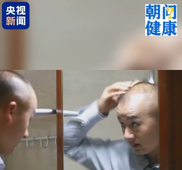 喝有水垢的水容易得肾结石？频繁洗头会导致脱发？直击真相
