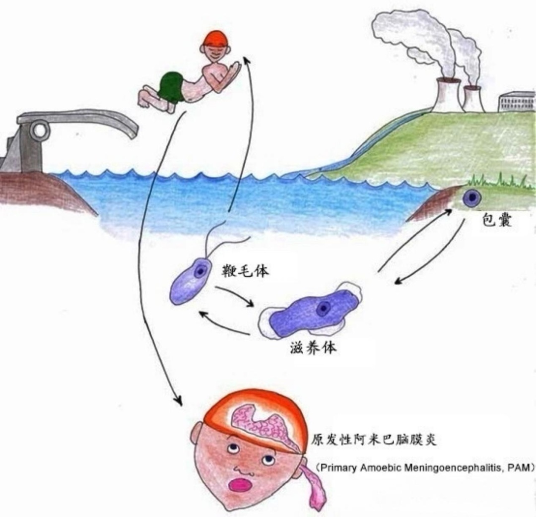 家长注意!儿童玩水后感染“食脑虫”,专家提醒→ 家长注意!儿童玩水后感染“食脑虫”,专家提醒→