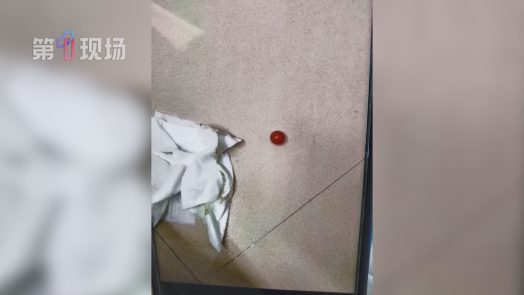 一岁幼儿吞食“水宝宝”差点肠穿孔！医生连夜手术抢救