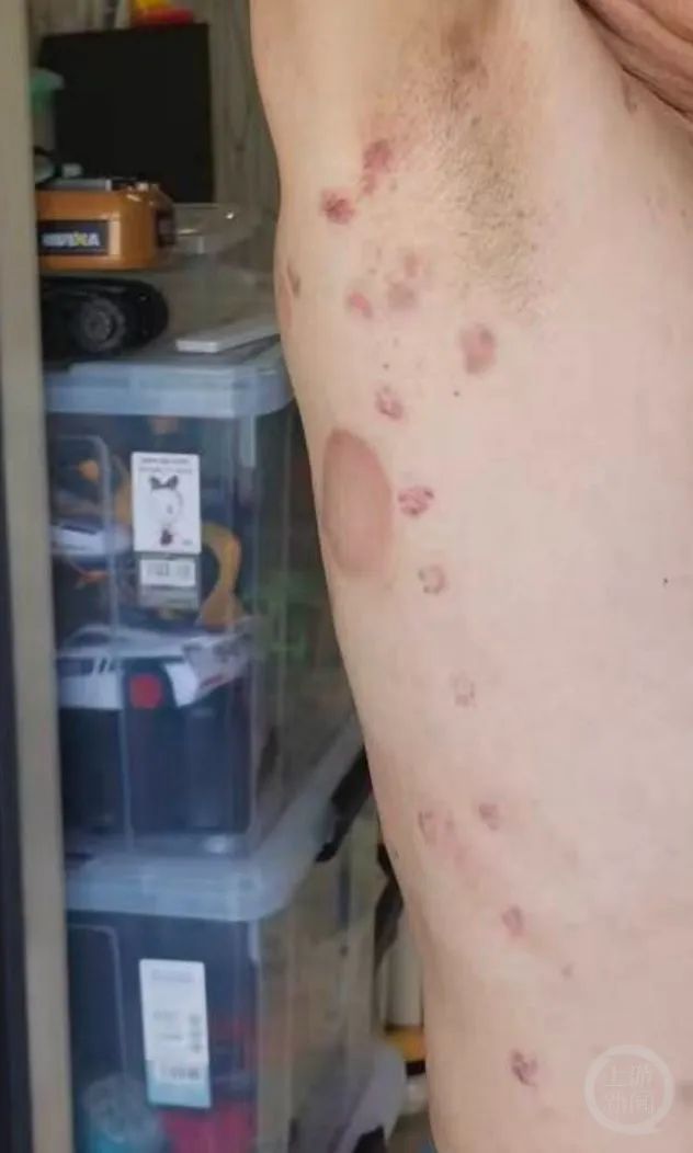 男子理发店充430万做针刺排毒和灌肠后身体不适，遭退费难！合肥警方：已展开调查