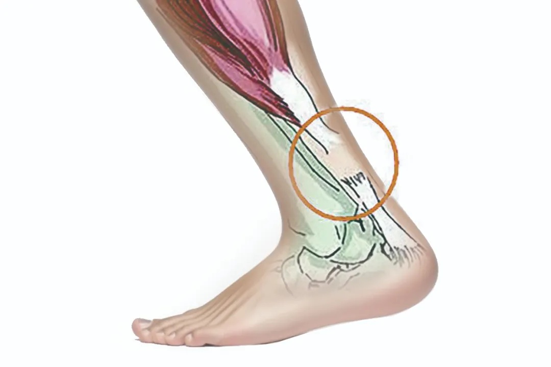 热搜第一吓坏网友：副作用这么严重？