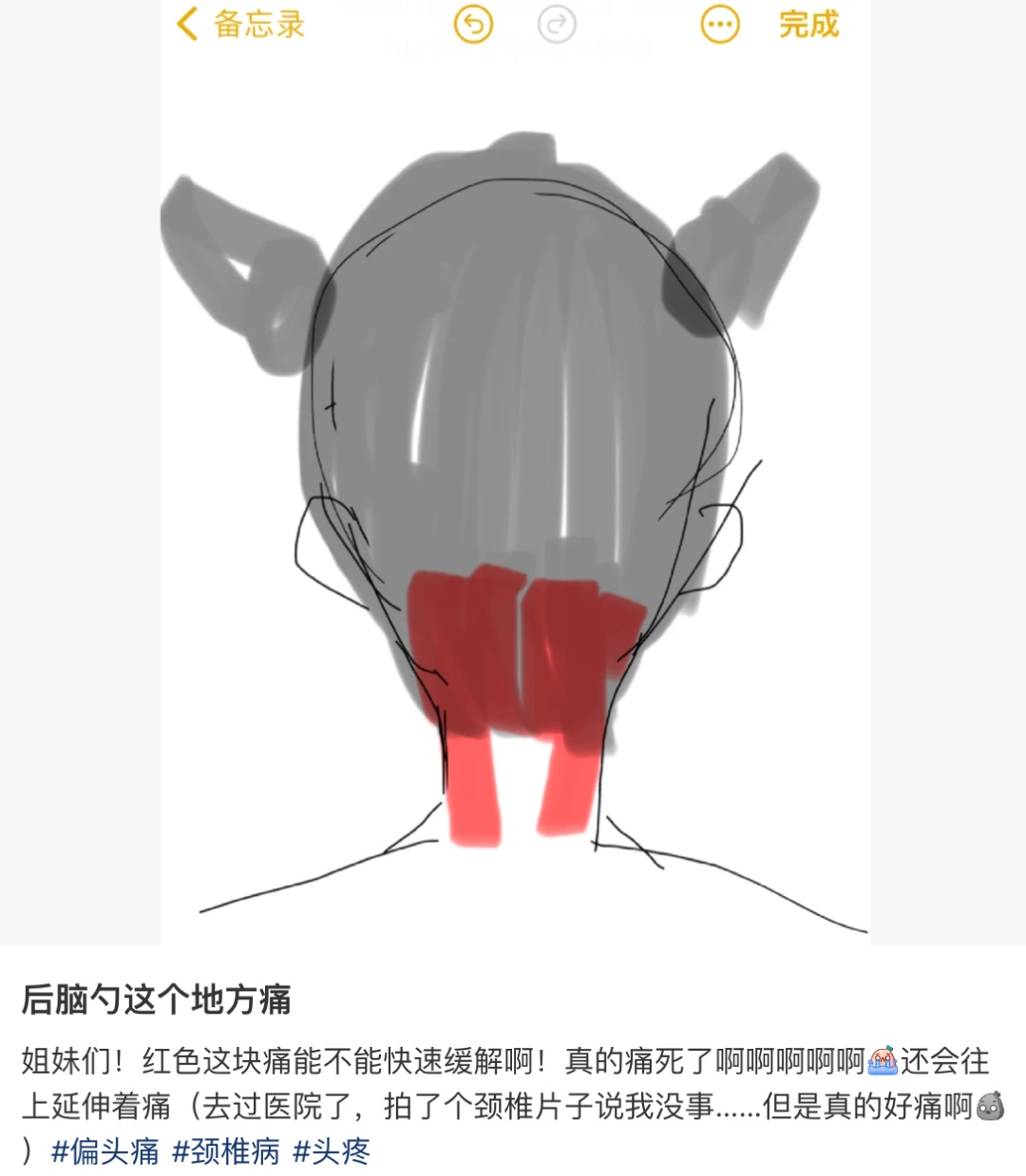 后脑勺下方疼，可能是这个原因！