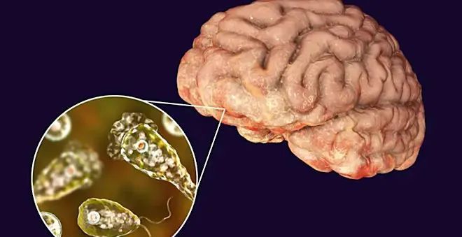 家长速看!孩子夏季玩水,警惕“食脑虫”! 家长速看!孩子夏季玩水,警惕“食脑虫”!