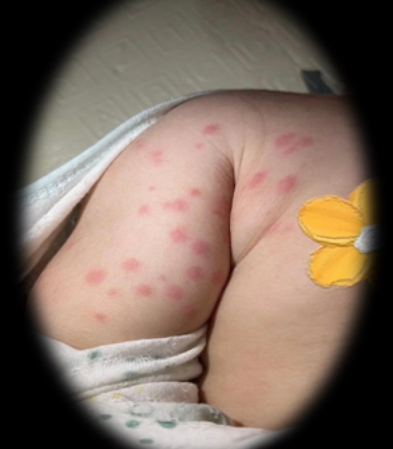 男子持续高烧被确诊！提醒：目前正是高发期，尽量减少在这些地方坐卧停留→