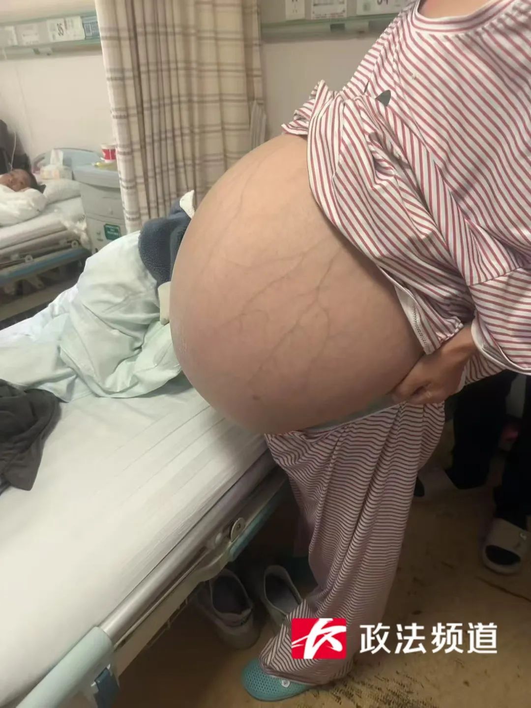 全国最大的肿瘤!湖南一女子盆腹腔长了38斤肿瘤,3个医生一起从其体内“抬出” 全国最大的肿瘤!湖南一女子盆腹腔长了38斤肿瘤,3个医生一起从其体内“抬出”