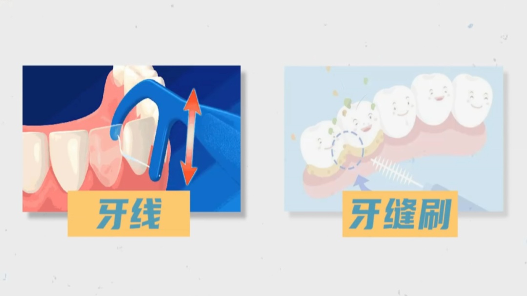 饭后立即刷牙有益?今天起,改掉这些刷牙习惯! 饭后立即刷牙有益?今天起,改掉这些刷牙习惯!