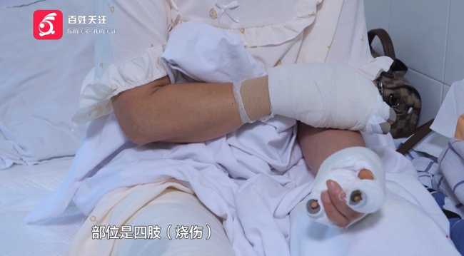 别碰！阿姨捡到“漂亮石头”，竟自燃起来导致自己烧伤！医生提醒：一旦起火很难扑灭