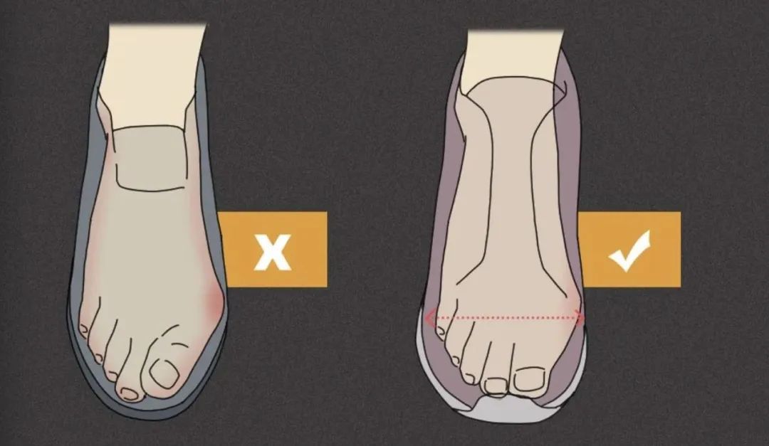 家里有这种鞋的!建议马上扔掉! 家里有这种鞋的!建议马上扔掉!