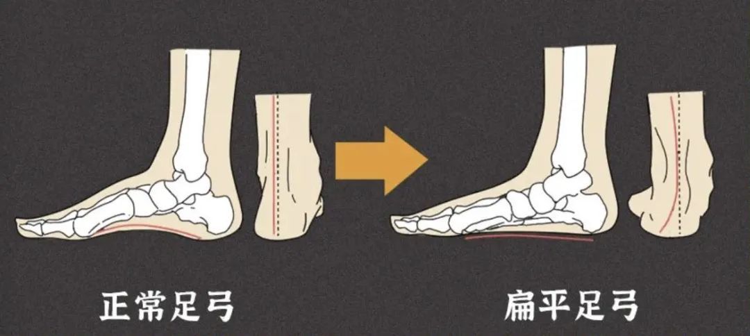 家里有这种鞋的!建议马上扔掉! 家里有这种鞋的!建议马上扔掉!