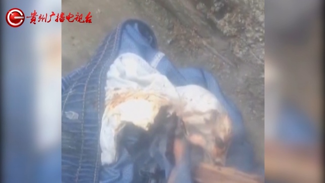 别碰！阿姨捡到“漂亮石头”，竟自燃起来导致自己烧伤！医生提醒：一旦起火很难扑灭