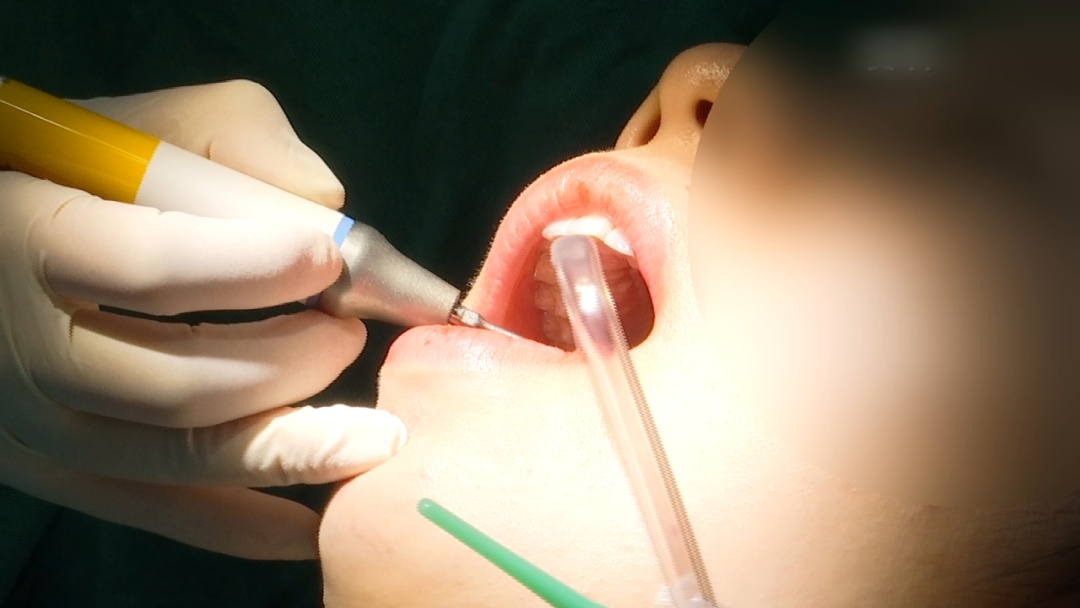 饭后立即刷牙有益?今天起,改掉这些刷牙习惯! 饭后立即刷牙有益?今天起,改掉这些刷牙习惯!