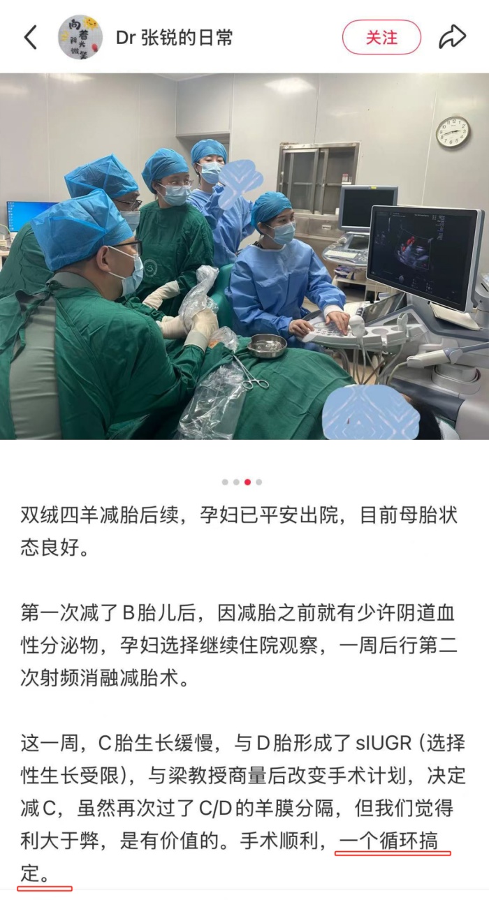 很罕见！一女子自然怀上四胞胎，其中一个......