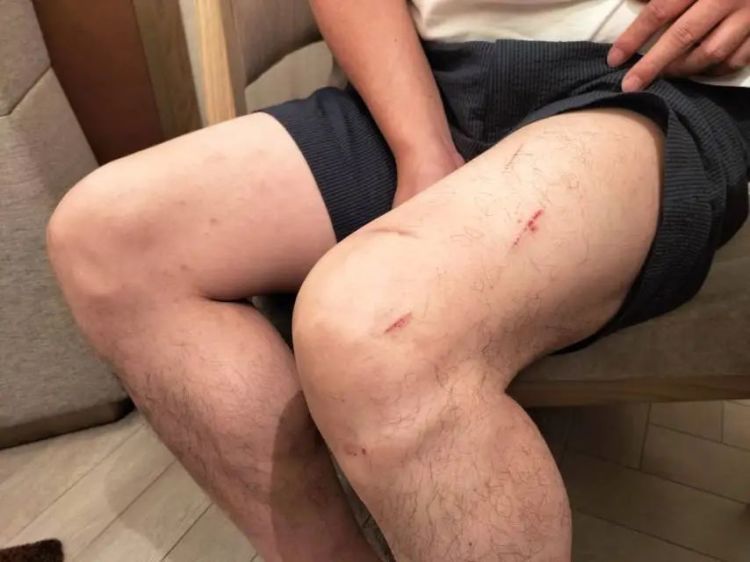 青岛一公园附近,少年不慎落海危在旦夕,“白衣大哥”迅速跳入海中…… 青岛一公园附近,少年不慎落海危在旦夕,“白衣大哥”迅速跳入海中……