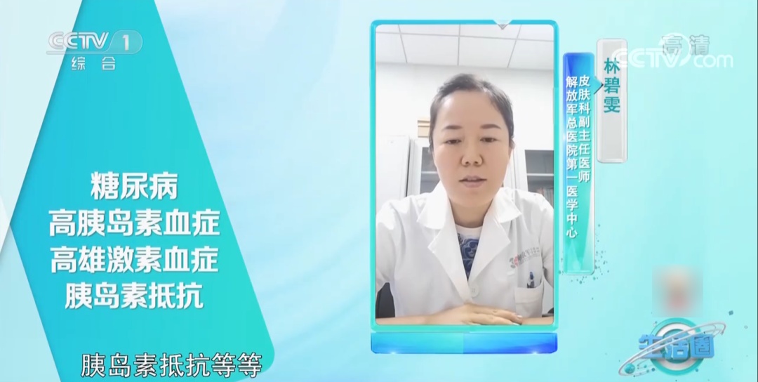 脖子发黑“洗不干净”？可能不是脏，是病！有这5种变化赶紧自查