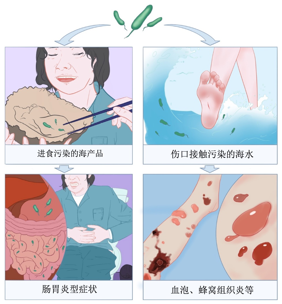 戴手套!戴手套!戴手套!死亡率近100%!小心这种“食人肉菌”… 戴手套!戴手套!戴手套!死亡率近100%!小心这种“食人肉菌”…