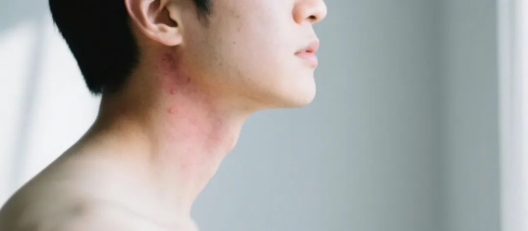 脖子发黑不是脏？真相吓一跳！脖子出现这5种变化，就要警惕→