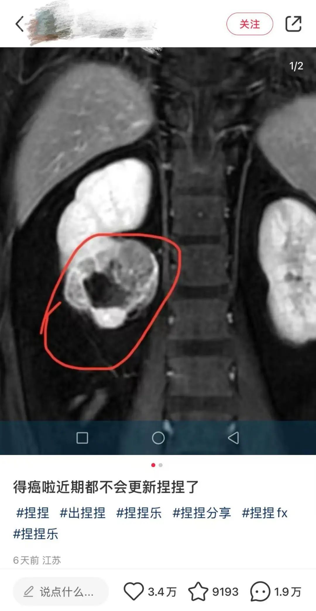 警惕!有毒物质100%超标,这款解压新宠你大概率也买过 警惕!有毒物质100%超标,这款解压新宠你大概率也买过