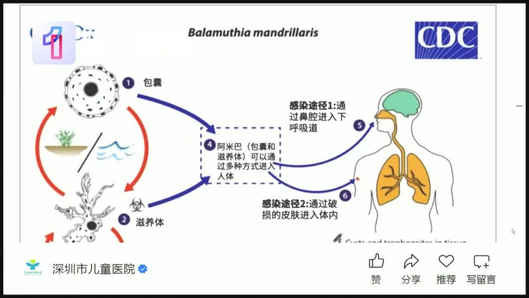 病死率高达97%！家长：还能带孩子去游泳吗？