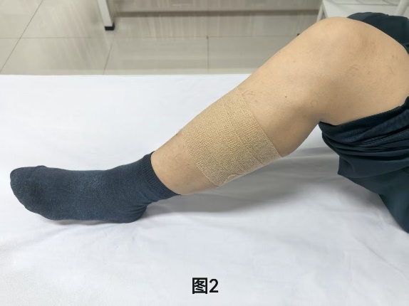 冰敷还是热敷？教你选择正确敷法来缓解不适