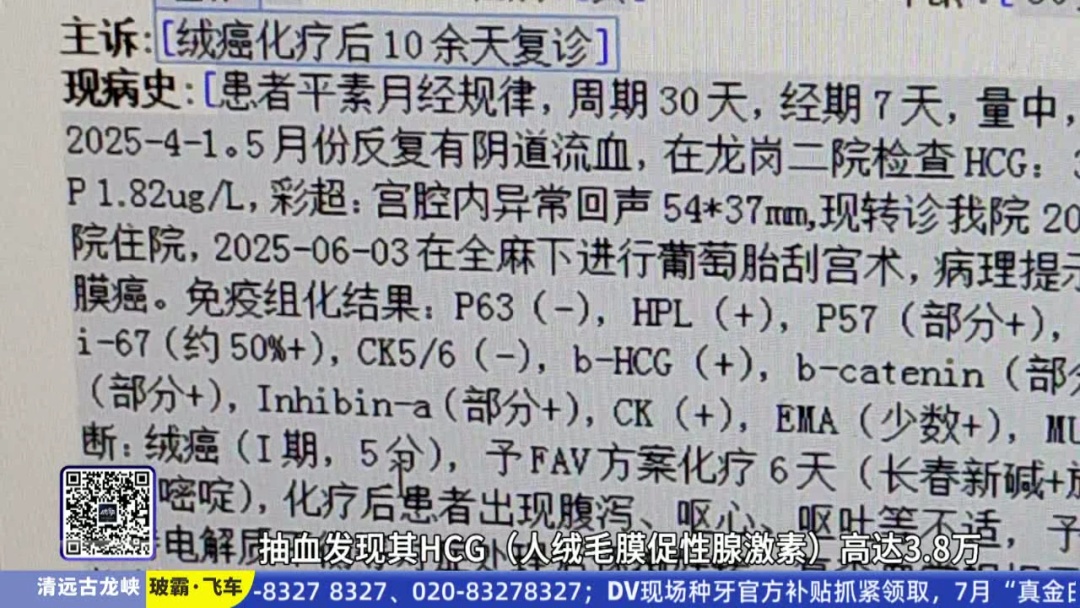 50岁女子意外怀孕竟诱发罕见癌症！医生提醒：这种癌非常少见