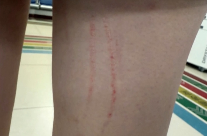 女子在电梯内被邻居的狗抓伤，对方说“去告我吧”