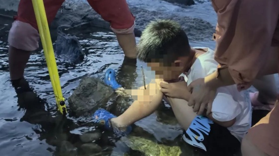 河边戏水被钢筋刺穿小腿,消防员抱着男孩徒步1.5公里送医! 河边戏水被钢筋刺穿小腿,消防员抱着男孩徒步1.5公里送医!