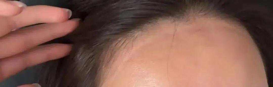 “防晒面罩越戴越黑”!是热黑的还是捂黑的? “防晒面罩越戴越黑”!是热黑的还是捂黑的?