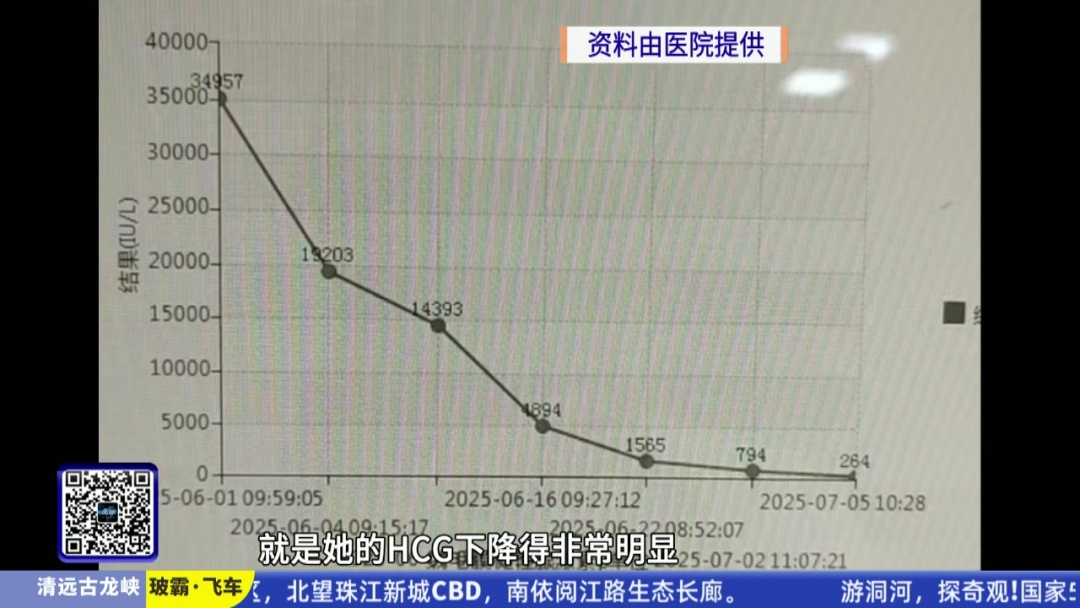 50岁女子意外怀孕竟诱发罕见癌症！医生提醒：这种癌非常少见