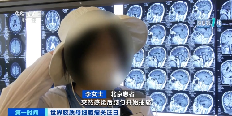 胶质母细胞瘤五年存活率仅有10%，突发恶心、头疼要警惕