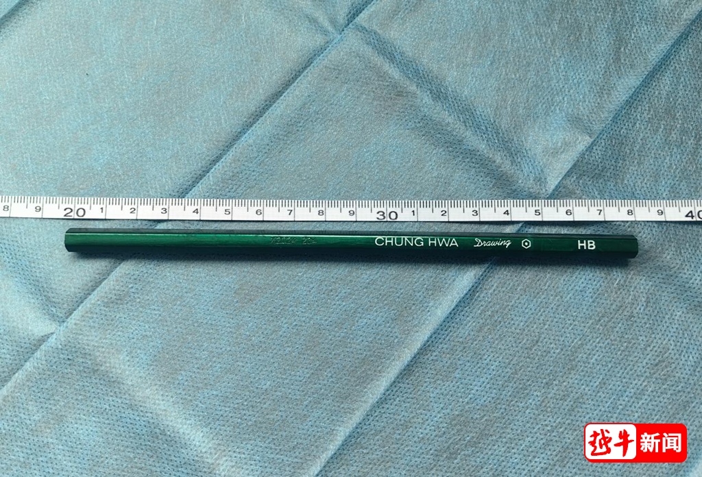 好奇害死猫！医生吓一跳！浙江一12岁男孩体内竟塞进了17cm长的...