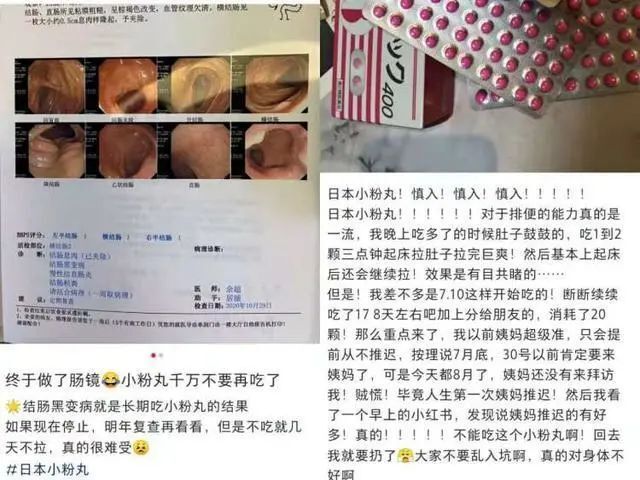 39岁80斤女子疯狂减肥到50斤！每天猛吞200粒“小粉丸”，送医时已皮包骨